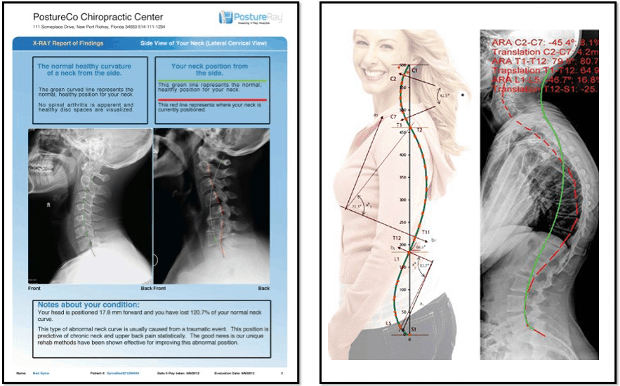 X-ray